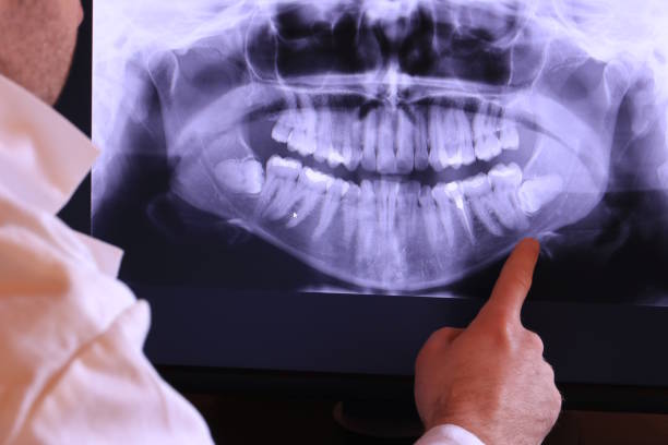 Best Emergency Dental Extractions in Oblong, IL