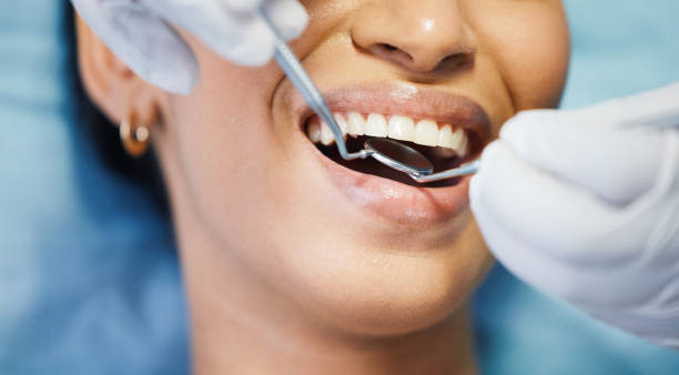 Best Emergency Dentist for Knocked-Out Tooth in Oblong, IL