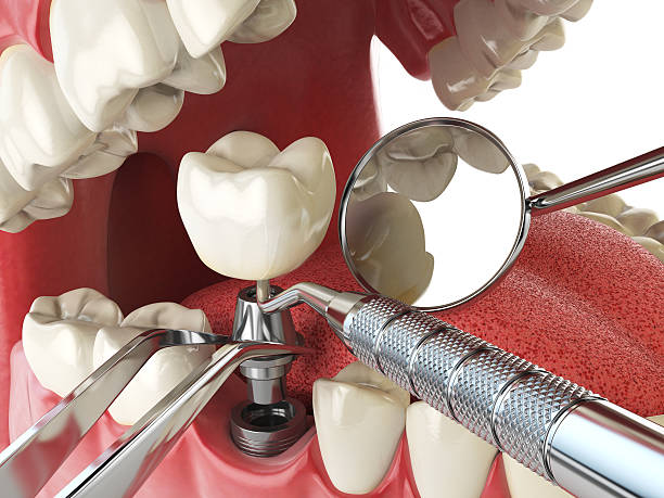 Best Urgent Dental Care for Toothache in Oblong, IL